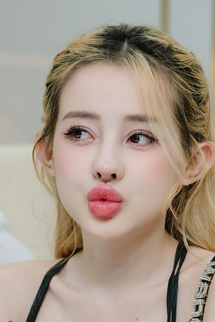 Diện mạo hiện tại của Ngân 98 sau 11 lần sửa mũi nhận được nhiều lời khen. (Ảnh: FBNV)