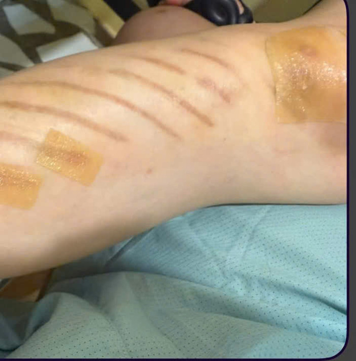 Hari Won gặp sự cố thang cuốn. Ảnh: FBNV