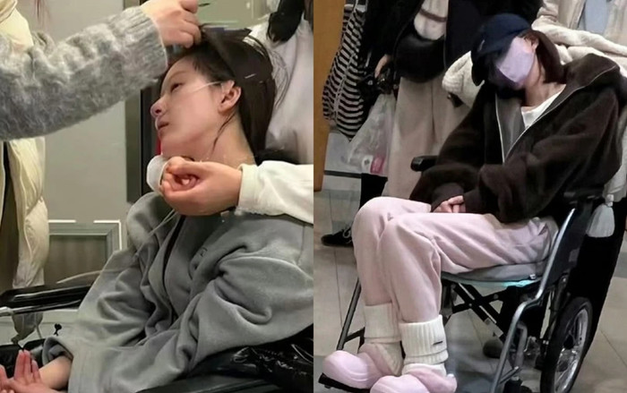 Vụ Triệu Lộ Tư đột quỵ và nỗi ám ảnh ngoại hình 'mình hạc xương mai' của sao Cbiz Ảnh 2