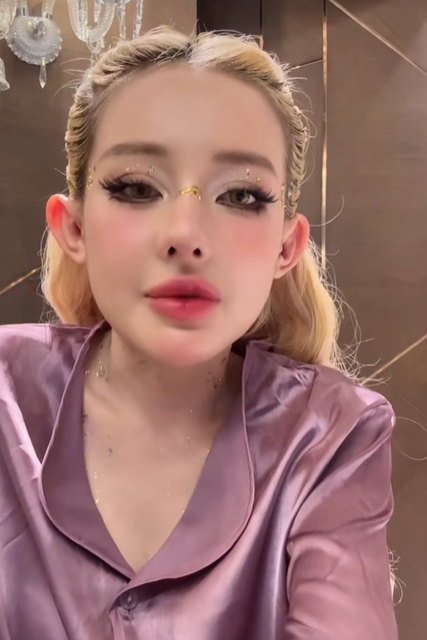 Trong livestream mới đây, Ngân 98 cho biết cô đang bị nhiễm trùng nặng ở phần mũi sau khi 'dao kéo'. (Ảnh chụp màn hình)