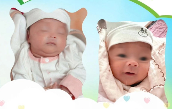 Cặp song sinh chào đời cách nhau 5 tuần. Ảnh: Bệnh viện cung cấp