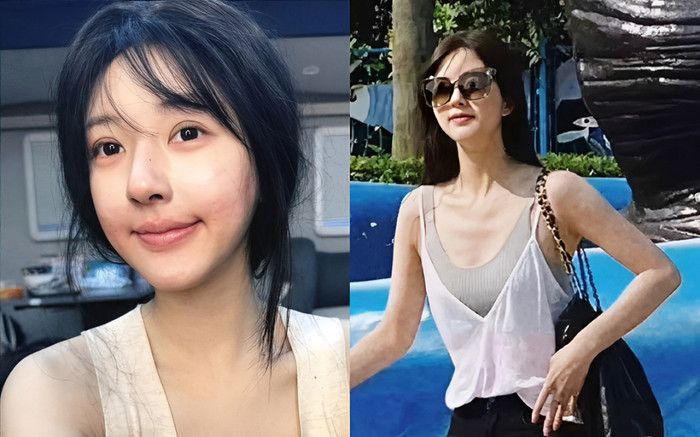 Hình ảnh Triệu Lộ Tư tiều tụy, chỉ còn 'da bọc xương' được lan truyền gây sốc Ảnh 2