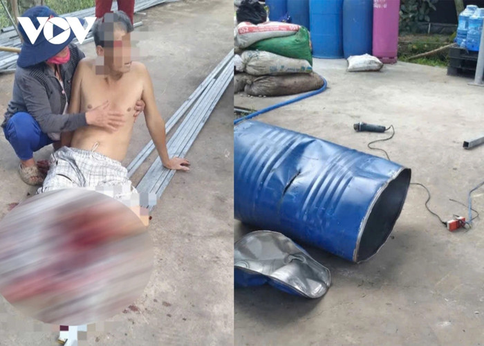 Ông Nh. bị thương nặng và chân không còn nguyên vẹn. Ảnh: VOV.