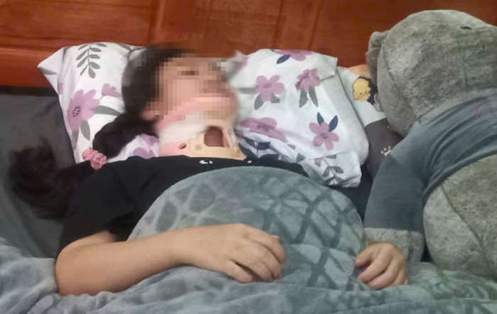 Nữ sinh lớp 11 gãy đốt sống cổ vì can ngăn đánh nhau.
