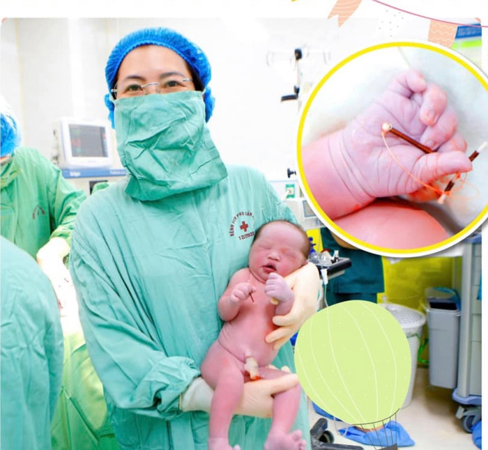 Sản phụ đeo vòng tránh thai vẫn sinh con khỏe mạnh 3,8kg.