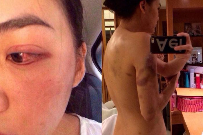 Janie Tienphosuwan từng thẳng thừng tố cáo chồng cũ bạo lực.