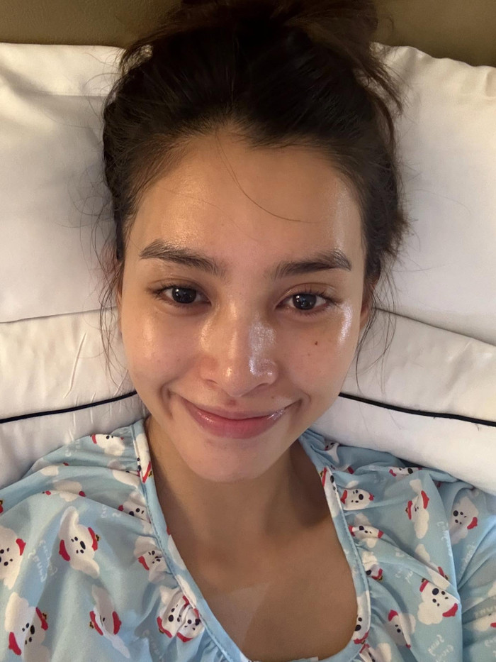 Hình ảnh mặt mộc của Hoa hậu Tiểu Vy gây ngỡ ngàng vì lộ nhiều khuyết điểm.