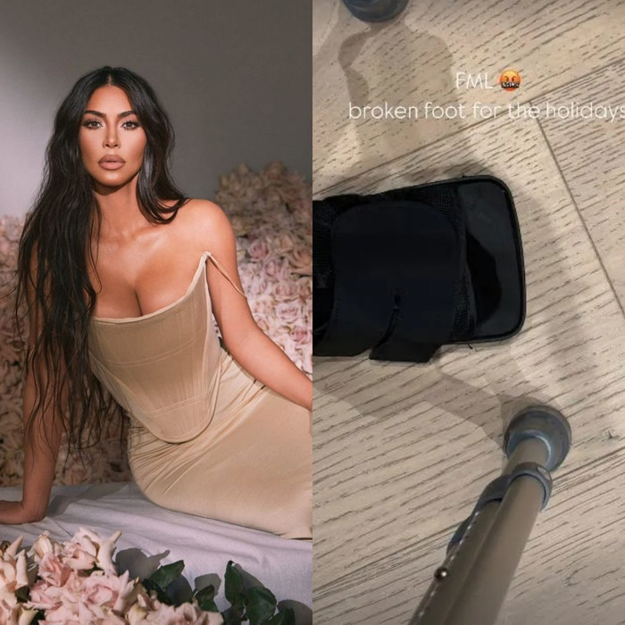 Người mẫu Kim Kardashian gặp sự cố gãy chân sau buổi chụp ảnh cực táo bạo trong rừng.