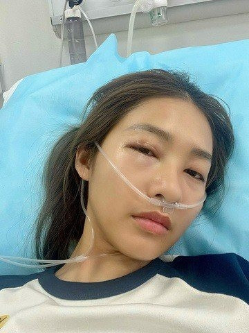 Khả Ngân phải nhập viện do dị ứng thuốc giảm đau. (Ảnh FBNV)
