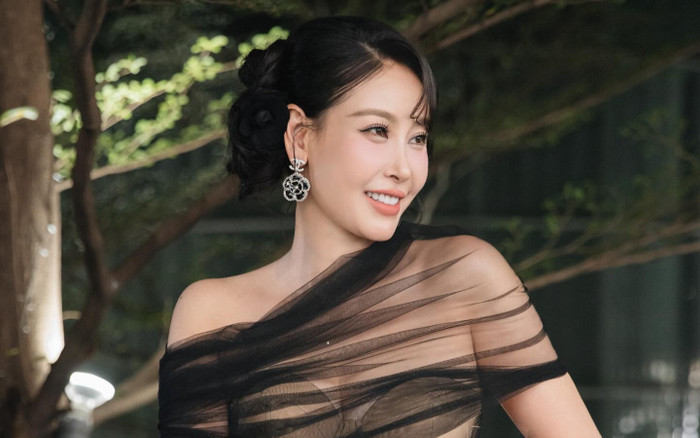 Quan điểm phẫu thuật thẩm mỹ của Hoa hậu Hà Kiều Anh Ảnh 2