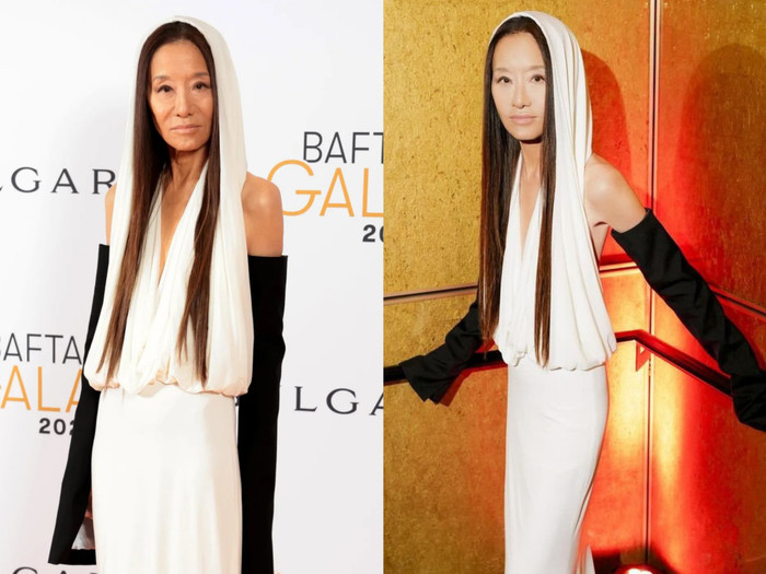 Khi so sánh hình ảnh tự đăng trên trang cá nhân và hiện trường sự kiện, có thể thấy các nếp nhăn trên mặt, xung quanh vùng cổ và lớp da lão hóa phần bụng đã được Nữ hoàng váy cưới giấu nhẹm đi. Nhiều khán giả cho biết các dấu hiệu trên có thể bắt nguồn từ việc lạm dụng phẫu thuật thẩm mỹ, căng da thời trẻ. 