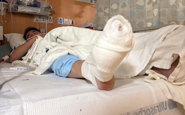 Đàm Vĩnh Hưng thông báo gặp tai nạn ở Mỹ, phải tạm hoãn liveshow Ảnh 2