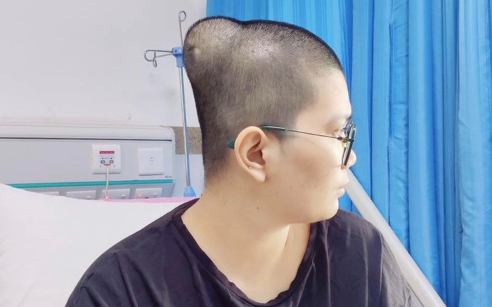 Nàng Hậu qua đời ở tuổi 29, khối u lớn di căn lên đầu Ảnh 2