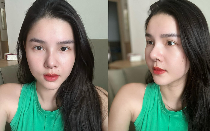 Kỳ Hân vừa sửa mũi, nhan sắc hiện tại ra sao? Ảnh 2