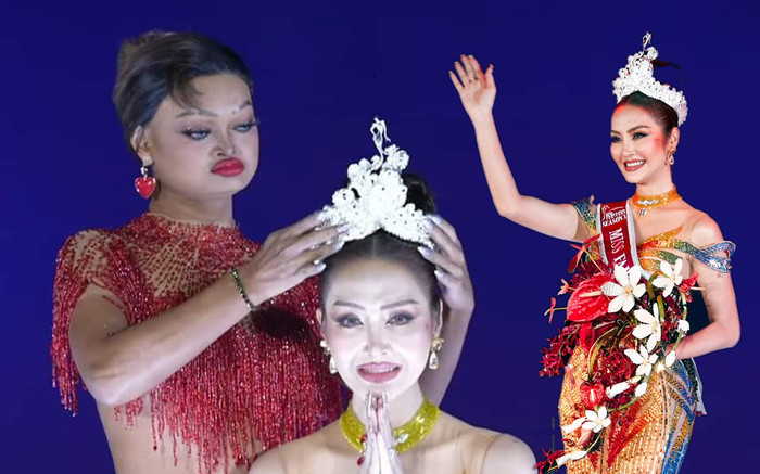 Hoa hậu không tóc, không răng đã có người kế nhiệm Ảnh 2