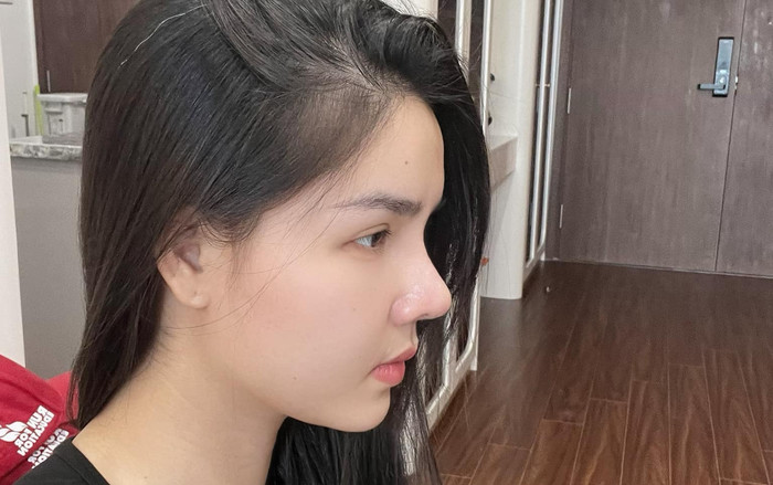 Kỳ Hân lộ dấu hiệu tuổi già sau khi 'đụng' dao kéo Ảnh 2