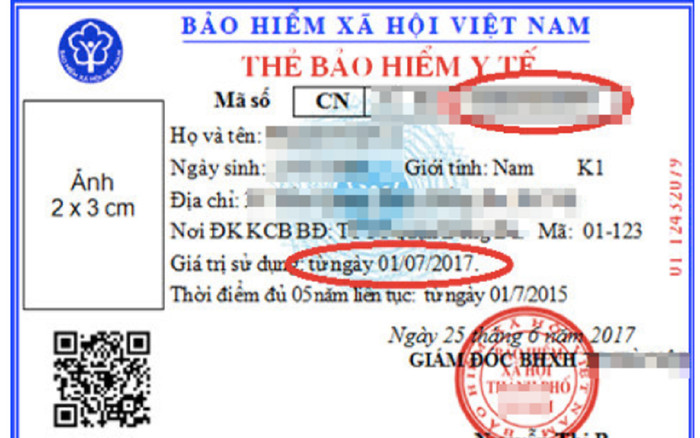 Vì sao thẻ BHYT mẫu mới không ghi ngày hết hạn sử dụng? Ảnh 2