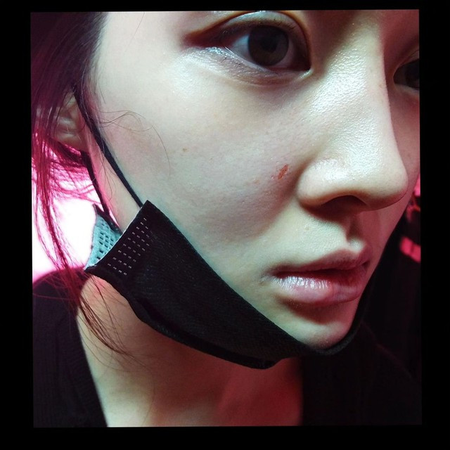 Những hình ảnh được Ahreum chia sẻ khiến nhiều khán giả bất bình trước cách hành xử của chồng cũ nữ ca sĩ. 