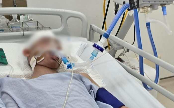 Vụ nam sinh lớp 8 bị đánh chấn thương sọ não: Gia đình xác định mất con, đưa về quê chuẩn bị hậu sự Ảnh 2