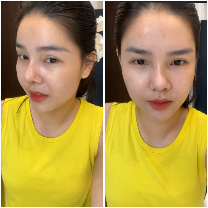 Nhan sắc thật kém lung linh của Kỳ Hân được tiết lộ là tác động của việc sửa mũi. 