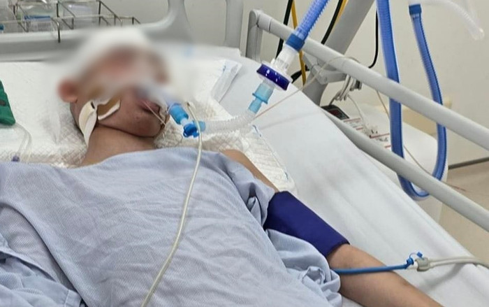 Công an TP Hà Nội thông tin vụ nam sinh lớp 8 bị đánh chấn thương sọ não khi chơi bóng rổ Ảnh 2