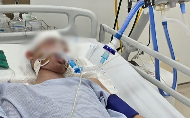 Tin mới về tình hình sức khỏe của nam sinh lớp 8 bị đánh chấn thương sọ não Ảnh 2