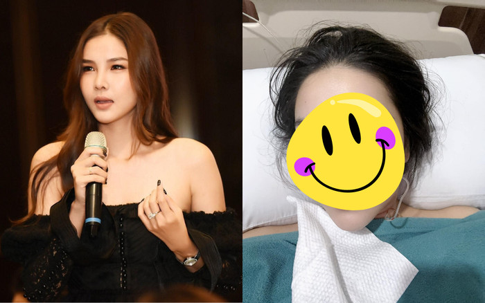 Kỳ Hân tiếp tục sửa mũi vì tụt sụn, vừa tỉnh đã cập nhật ngay diện mạo mới Ảnh 2