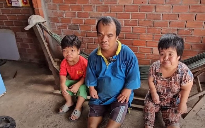 Gia đình 3 người tí hon, cuộc sống hiện tại khiến tất cả xót xa Ảnh 2