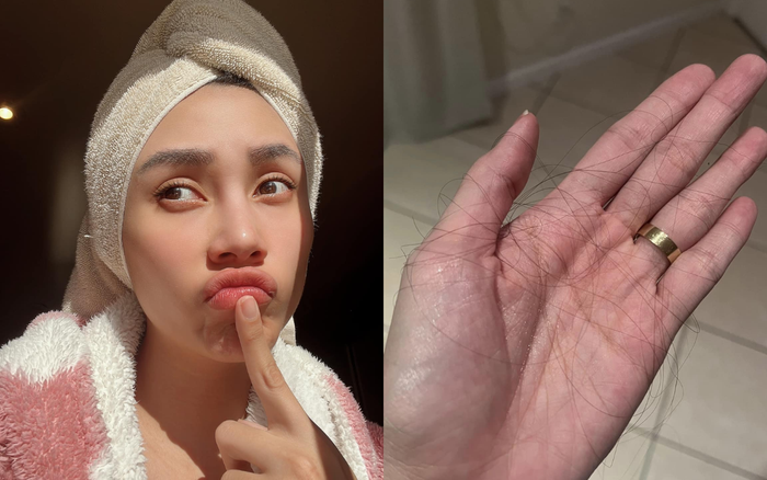 Võ Hoàng Yến lo lắng vì tóc rụng nhiều khi mang thai lần đầu. Ảnh: FBNV