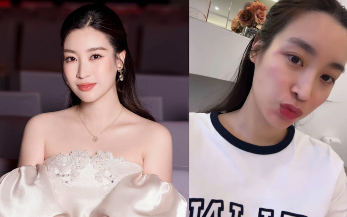 Hoa hậu Đỗ Mỹ Linh can thiệp thẩm mỹ, hiếm hoi công khai với công chúng Ảnh 2