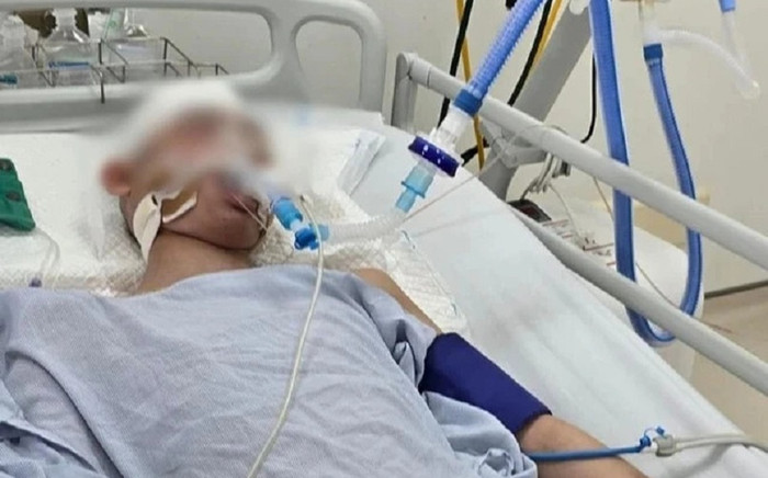 Cập nhật mới nhất về tình hình sức khỏe nam sinh bị đánh chấn thương sọ não Ảnh 2