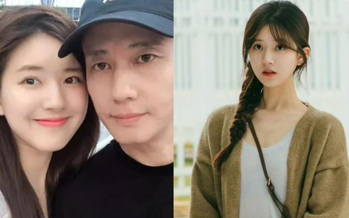 Triệu Lộ Tư chứng minh không phẫu thuật thẩm mỹ qua chi tiết này Ảnh 2