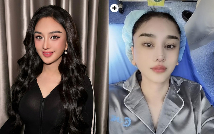 Hình ảnh mới nhất của Lâm Khánh Chi sau khi tiếp tục can thiệp 'dao kéo' Ảnh 2