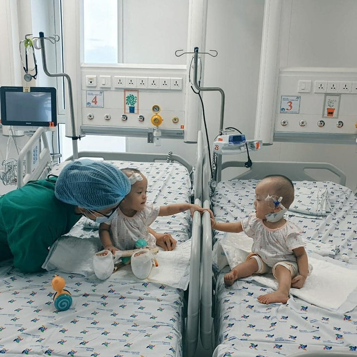 Ca phẫu thuật tách 2 em bé Trúc Nhi - Diệu Nhi liền cơ thể được đánh giá là ca phẫu thuật cực phức tạp