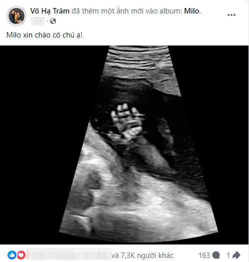 Võ Hạ Trâm khoe ảnh siêu âm của nhóc tỳ thứ hai, chưa lên tiếng là bé trai hay gái.