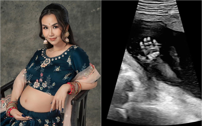 Võ Hạ Trâm khoe ảnh siêu âm con thứ 2, để lộ chi tiết khiến dân tình đoán là 'hoàng tử bé' Ảnh 2