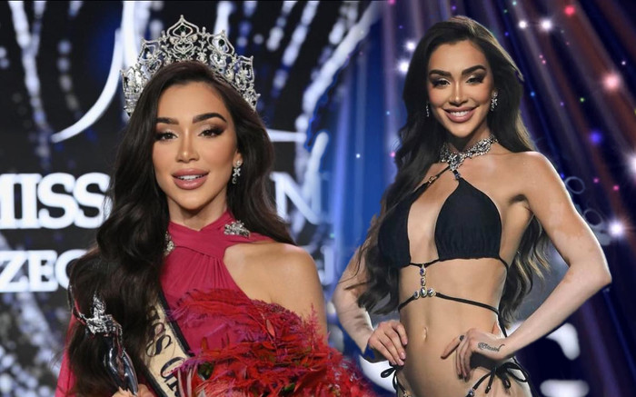 Body đẹp như tạc tượng của tân Hoa hậu Hòa bình CH Séc 2024 Ảnh 2