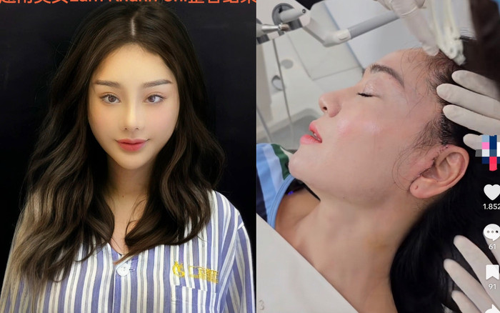 Một nữ diễn viên căng da mặt giống hệt Lâm Khánh Chi, kết quả khiến netizen lo sợ Ảnh 2