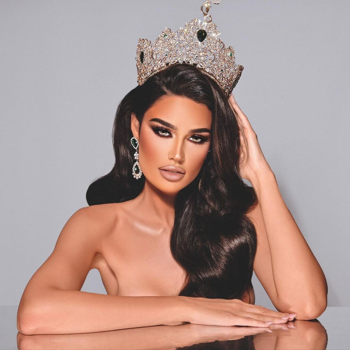Nhan sắc rực rỡ của tân Hoa hậu khiến mọi người mê đắm. Ảnh: Miss Grand International. 