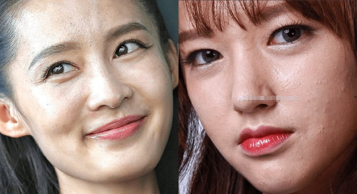 Dù còn trẻ nhưng Lý Thấm và Trình Tiêu đều gặp vấn đề về da mụn và lỗ chân lông to, có thể do trang điểm thường xuyên.