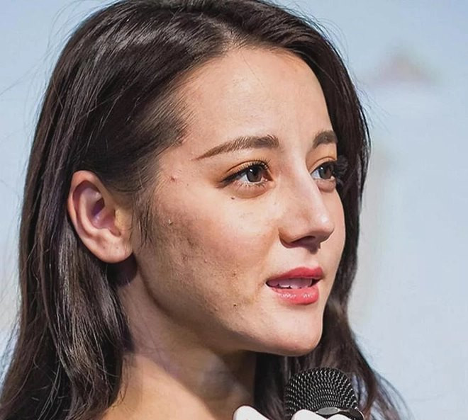 Địch Lệ Nhiệt Ba từng khiến fan ngỡ ngàng khi lộ ảnh mặt mộc với làn da khô, đen, nhiều mụn và lỗ chân lông to.