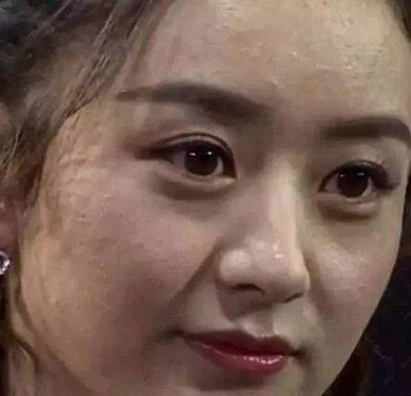 Triệu Lệ Dĩnh được yêu thích bởi vẻ ngoài ngọt ngào, trong trẻo. Tuy nhiên, khi không qua bộ lọc, làn da của cô lại sần sùi, nhiều nếp nhăn và quầng thâm ở mắt.