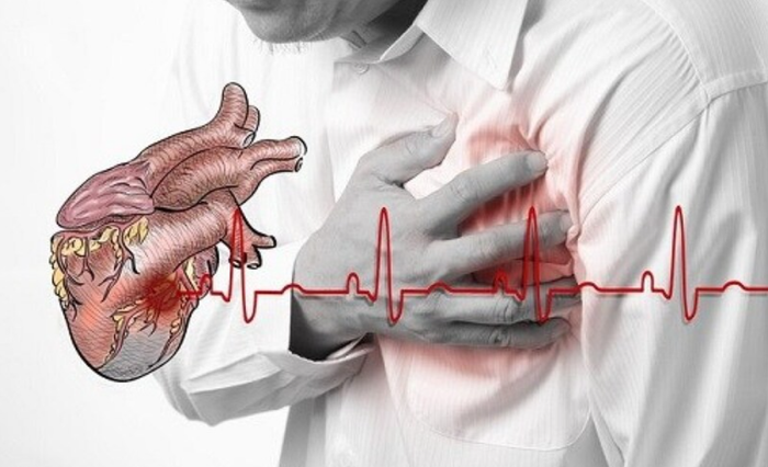 Theo Hiệp hội Tim mạch Mỹ, mỗi năm có khoảng 50.000-80.000 người chết vì đột tử do tim.