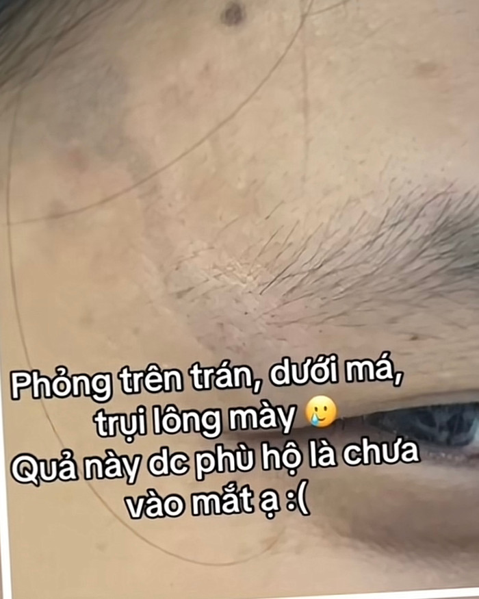 Để cảnh báo, cô gái đã vội đăng clip chia sẻ đến cộng đồng mạng.&nbsp;