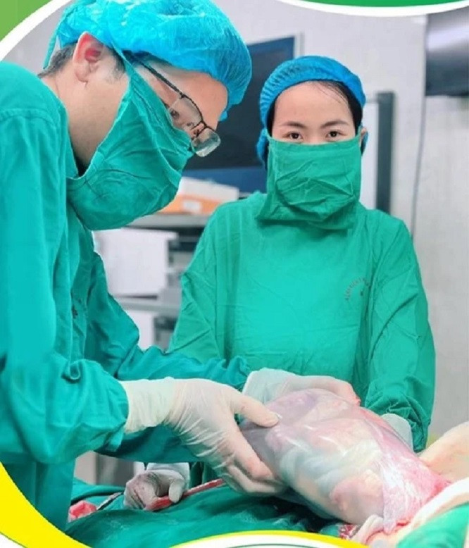 Em bé chào đời còn nằm nguyên trong túi ối tại Bệnh viện Phụ sản Hà Nội. Ảnh: Bệnh viện Phụ sản Hà Nội