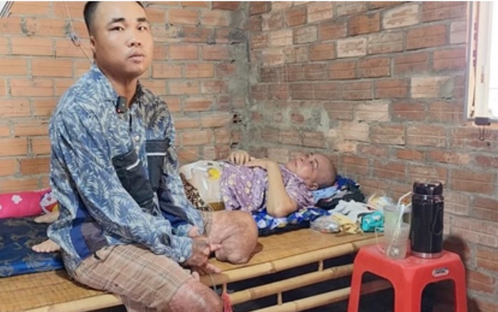 Lao vào biển lửa cứu mẹ, anh phụ hồ bị mất đôi chân nhưng vẫn mưu sinh kiếm sống Ảnh 2