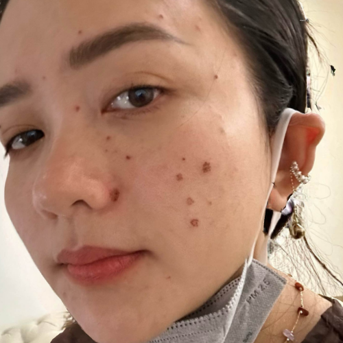 Cận cảnh làn da hiện tại của người đẹp Phan Như Thảo.