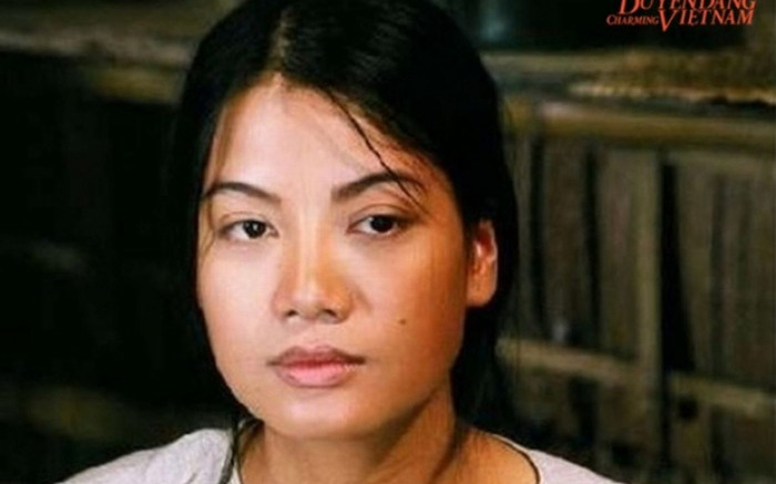 Trương Ngọc Ánh từng suýt bị mù, ám ảnh 3 tháng không dám gặp ai vì lý do khó ngờ Ảnh 2