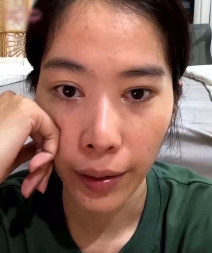 Từng có nhan sắc chuẩn hoa hậu nhưng giờ đây sắc vóc của Nam Em “lúc lên lúc xuống” hệt như tính cách của cô nàng. Trong một buổi livestream, do vô tình tắt filter mà người đẹp đã để lộ mặt mộc kém sắc và hốc hác khiến netizen bàn tán xôn xao. 