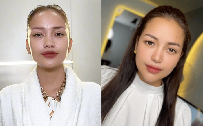 Hoa hậu Ngọc Châu công khai can thiệp làm đẹp, nhan sắc hiện tại lạ lẫm Ảnh 2